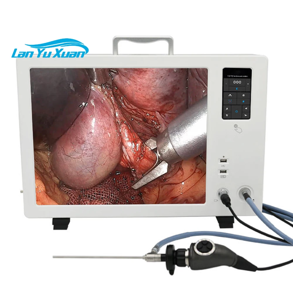 Factory price 4 in 1 Full HD 4K medical endoscope camera system with 24 inch 100W LED light source and HD recorder