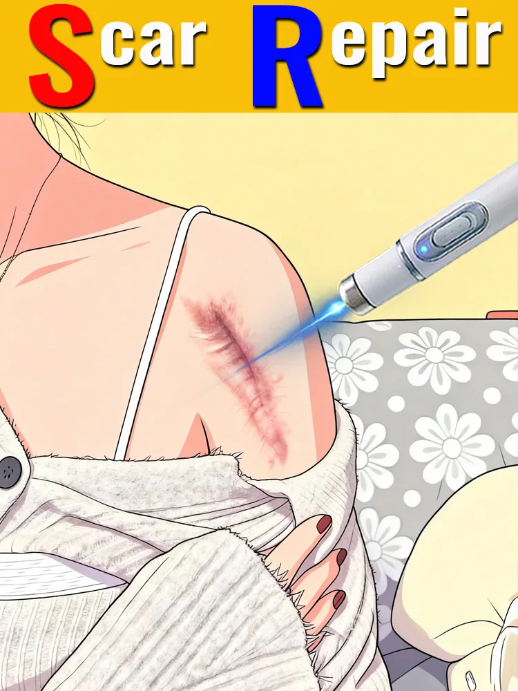 

Home-use portable blue laser pointer for ʳᵉᵐᵒᵛⁱⁿᵍ ᵛᵃʳⁱᵒᵘˢ ᵒˡᵈ ˢᶜᵃʳˢ