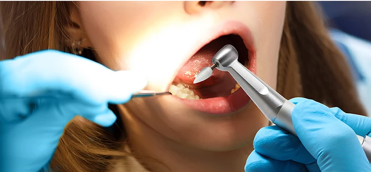 40 Teile/schachtel AZDENT Dental Composite Harz Polierer Polieren Werkzeug Tasse Punkt Disc Form CA 2,35mm für Niedrige Geschwindigkeit handstück – Detail 10