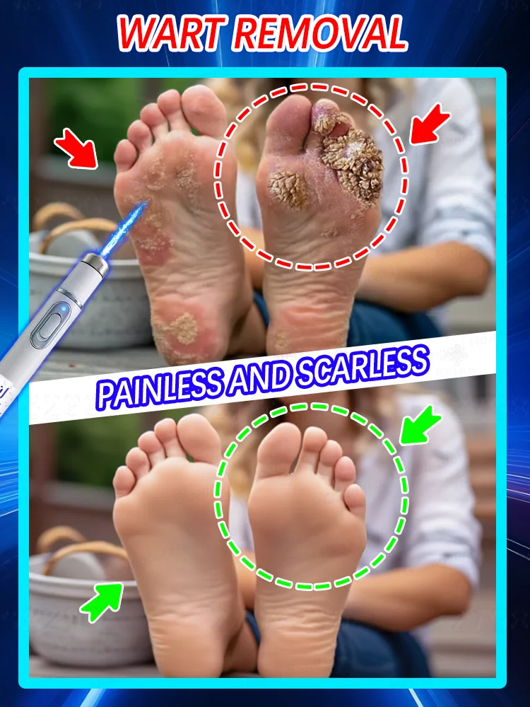 

2025 Hot sale Say goodbye to nail troubles Simple and convenient