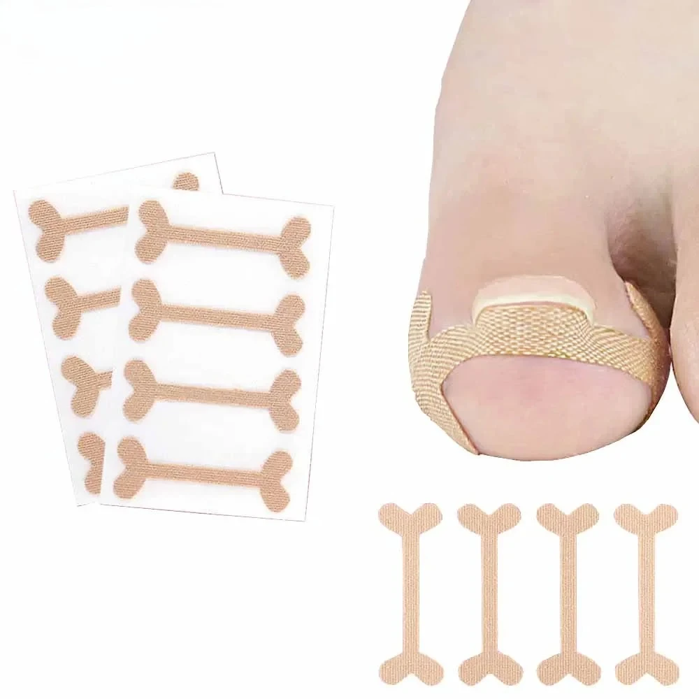 20-100pcs Adhesive Toenail Patch Ingrown Toe Nail Correction Sticker Foot Corrector Pedicure Foot Care Tools Toe Care Pad