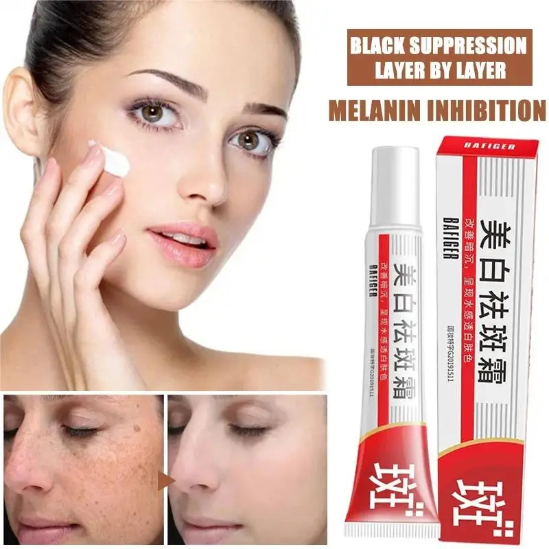 Whitening Freckles Cream Effective Remove Melasma Dark Spots Fade Pigmentation Moisturize Brighten Korean Face Skin Care Product