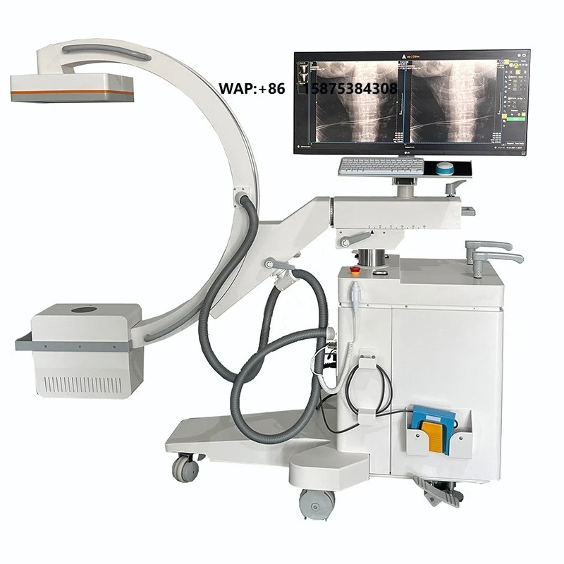 5kW Mobile High Frequency C-Arm X-ray Machine Multifunctional Digital Surgical C-Arm X-ray Machine