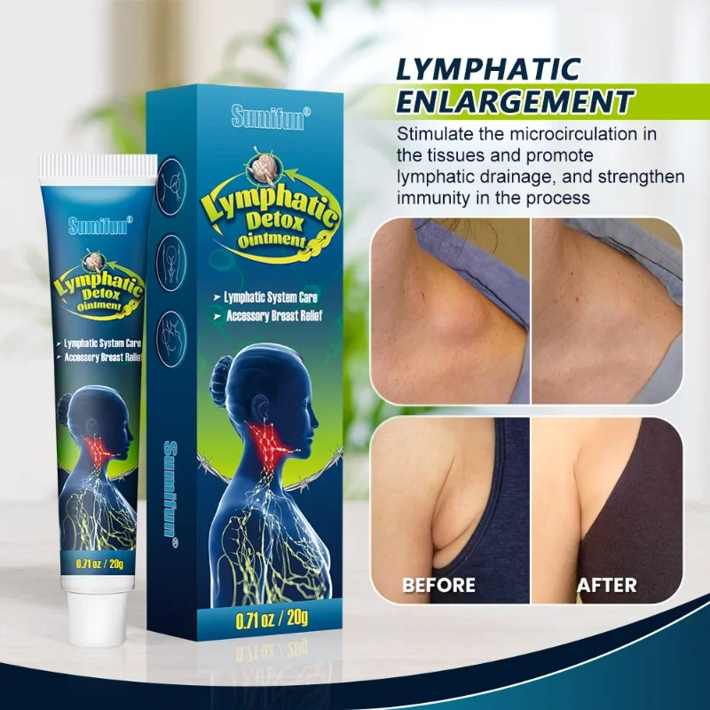 Newly Professional Lymphatic Massage Cream Effectively Eliminate Lymph Nodes Vice Breast Elimination Cream 20g