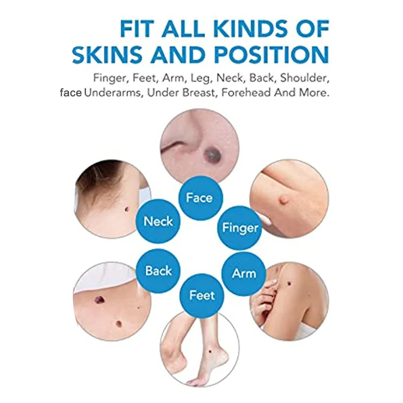 Best 2 In1 Painless Auto Skin Tag Mole Wart Removal Kit Skin Care Body Wart Dot Treatments Remover Cleaning Tools