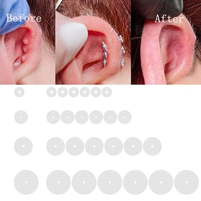 

100pcs Stabilizer Earrings Backings Clear Silicone Earrings Back Stopper Practical Healing Discs Pads for Ear Support