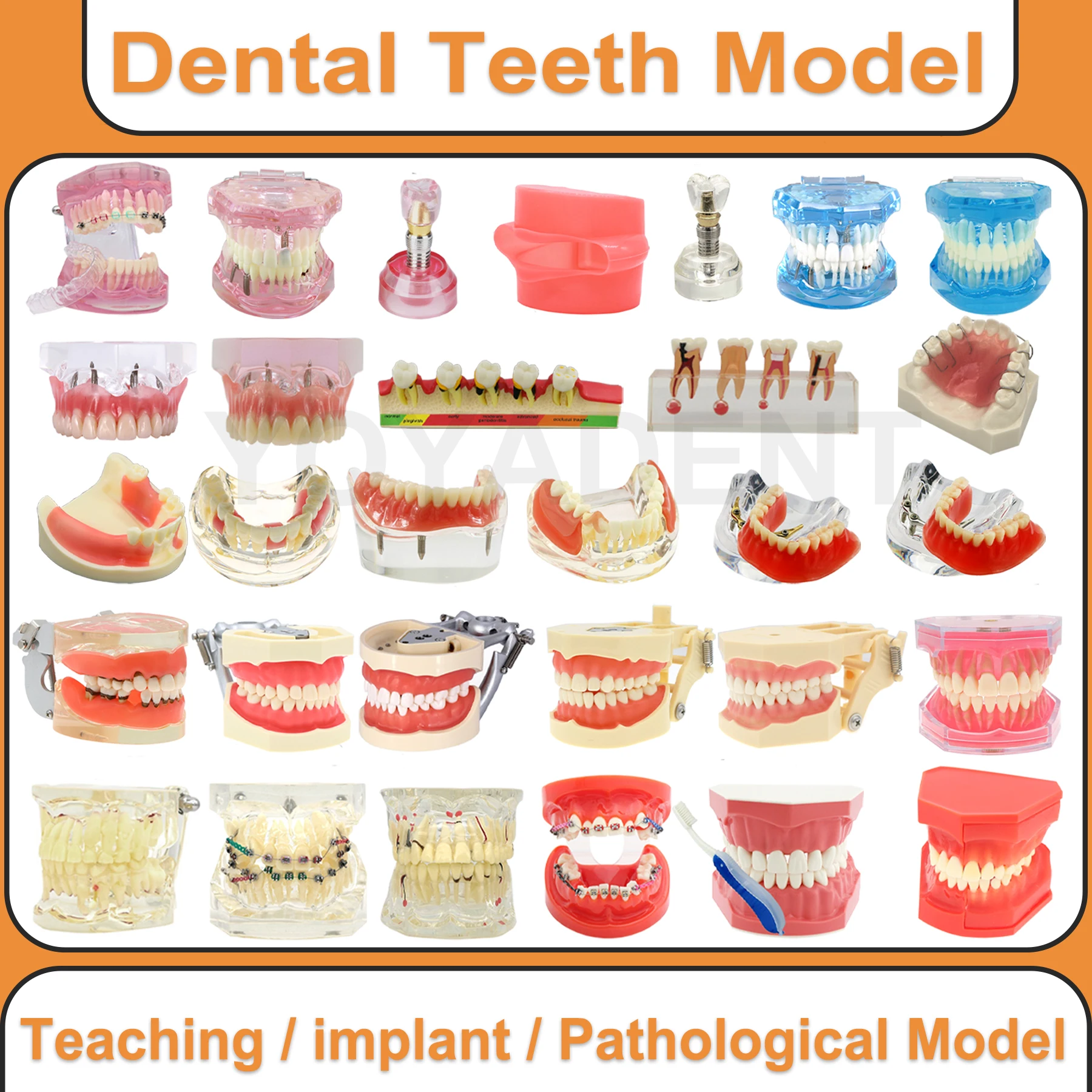 

Модель зубов, съемные модели зубов имплантата для пациента, ортодонтическое образование, демонстрационный материал для стоматолога