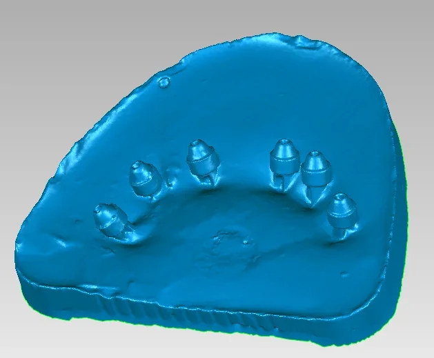 3D口腔内スキャナー,歯科技工所,口腔外,最も科学的