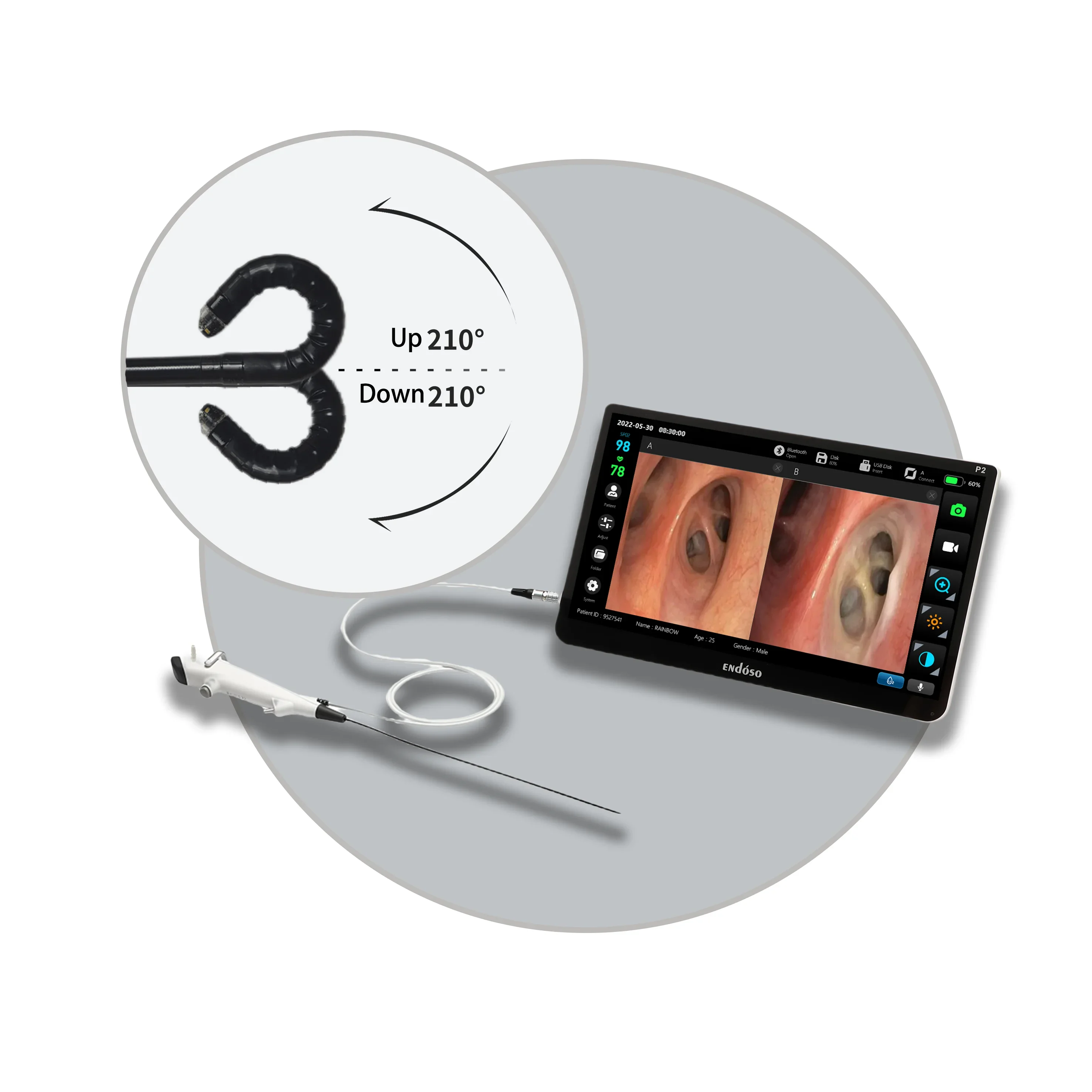Manufacturer Price Endoso USB Connector Digital Flexible Cystoscope Single Use for Urology Surgery