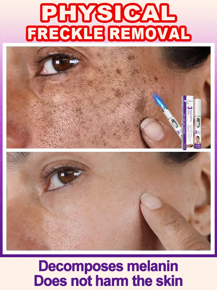 【Powerful and effective】Laser fights melanin! Make your skin fair and translucent