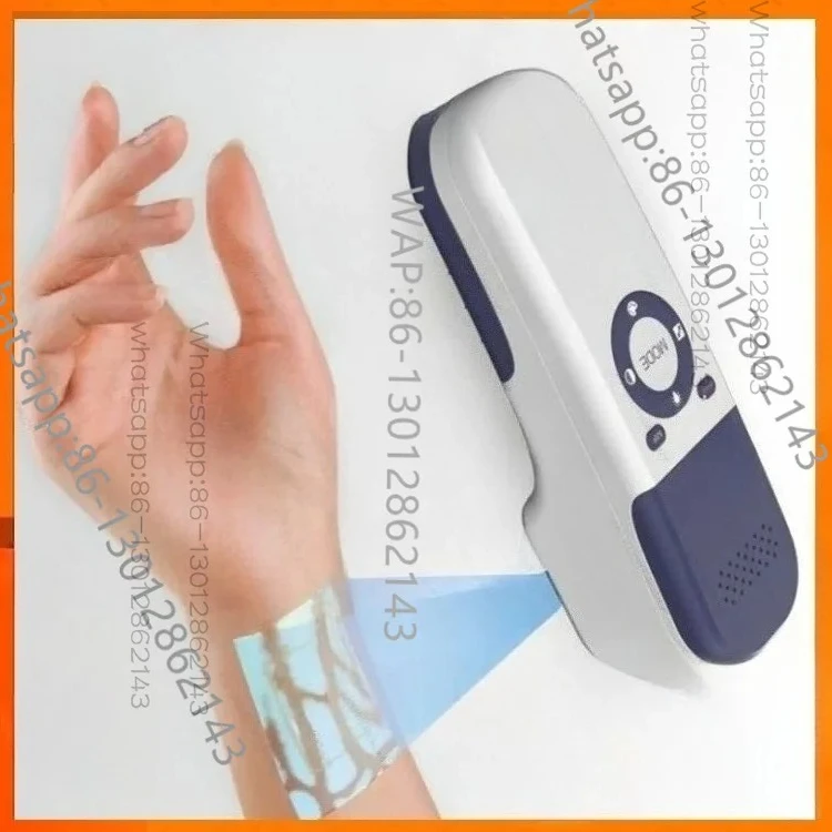 Hand‑held Infrared Vascular Scanner Vein Viewer Detector Portable Vein Locator for Hospital Clinic