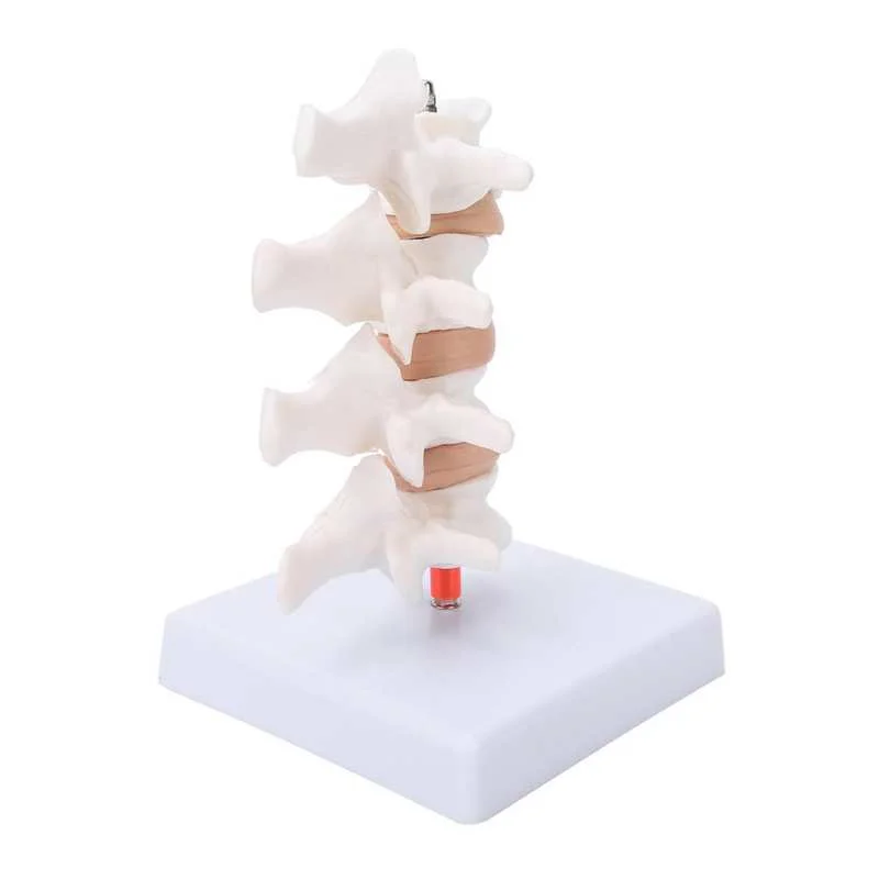 

Human Osteoporosis Anatomical Vertebrae Model - Medical Skeleton Anatomy