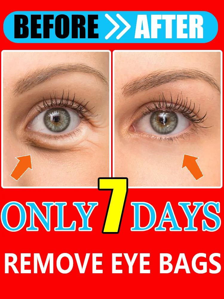 

Fᴀsᴛ-Rᴇsᴜʟᴛs Eʏᴇ Cʀᴇᴀᴍ - Fᴀᴅᴇ Sʜᴀᴅᴏᴡs & Sᴏᴏᴛʜᴇ Pᴜғғɪɴᴇss, 2025 Tᴏᴘ Pɪᴄᴋ