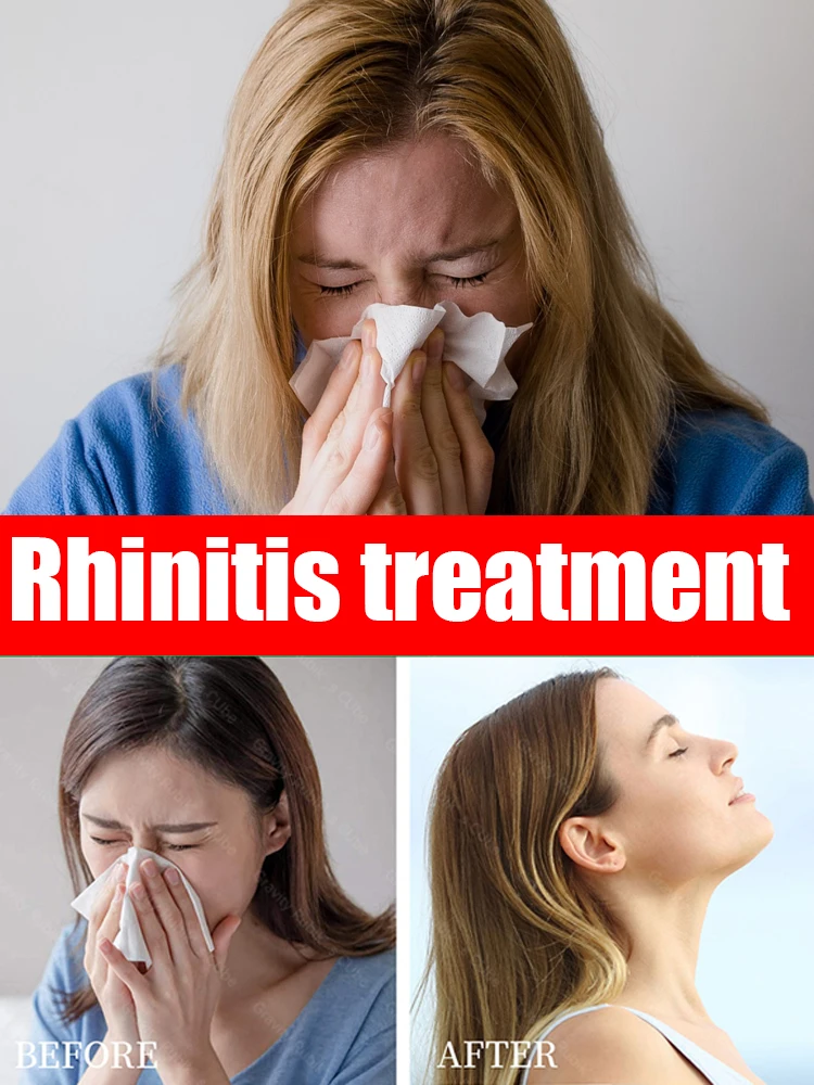 

Rhinitis treatment device