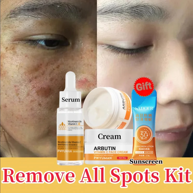 Vitamin C Whitening Freckles Face Serum Cream Set Remove Dark Spots Melasma Niacinamide Lighten Melanin Acne Anti-aging SkinCare