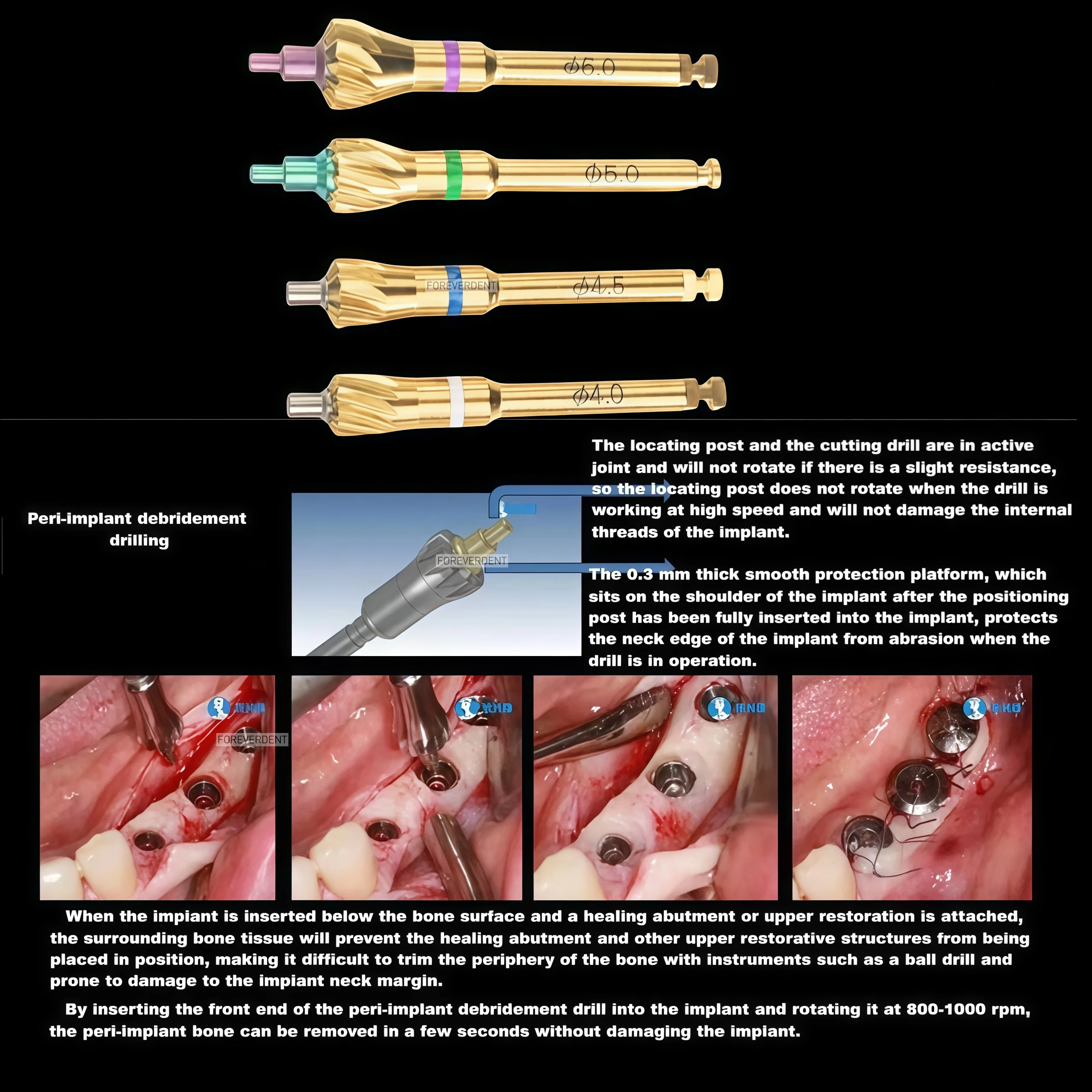 Dental Grinding Bur Universal Implant Bone Profiler With Pilot Drill Implant Debridement Surgical Instrument
