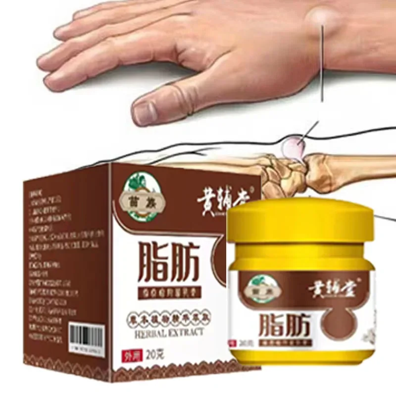 

Lipoma Removal Cream Body Cream Dissolving Fat Easy To Use Lipoma Removal Cream