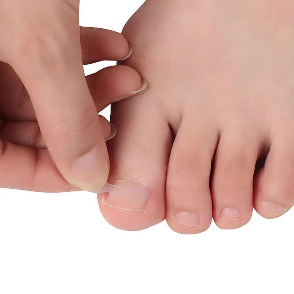 

30 Pcs Orthopedic Stickers Curved Toenail Patch Ingrown Orthopaedic No Glue Corrector Resin Tool