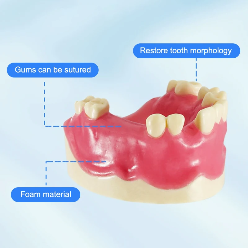 

Teeth Loss Model Dental Implant Student Teaching Training Aid Practice Model Upper Jaw Lift Implants Restoration Model Lab