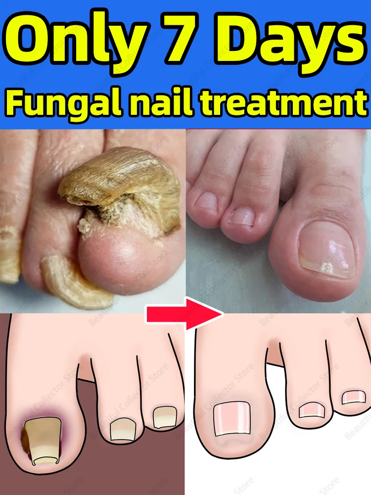 

Handle all the nail trouble