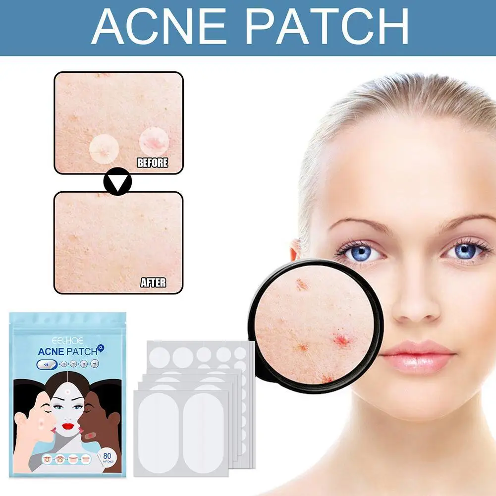 8/10/12mm*16pcs+14mm*12pcs+30*60mm*20pcs Large Size Hydrocolloid Bandage For Acne Skin Blemish Remover Q8U5