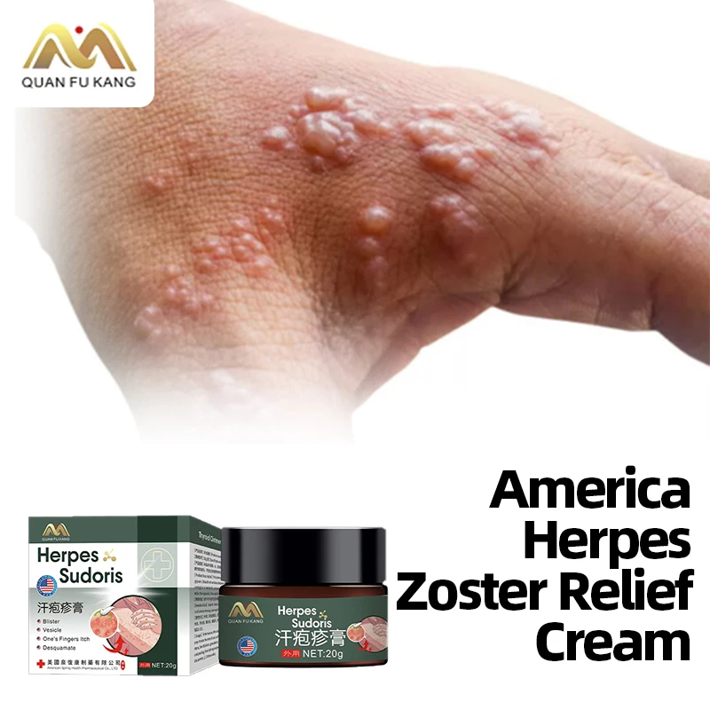 Crema para el tratamiento del Herpes Zoster, pomada simple para el Herpes, serpiente, dolorido, puntos rojos, Blister, cuela la piel, medicina, fórmula americana