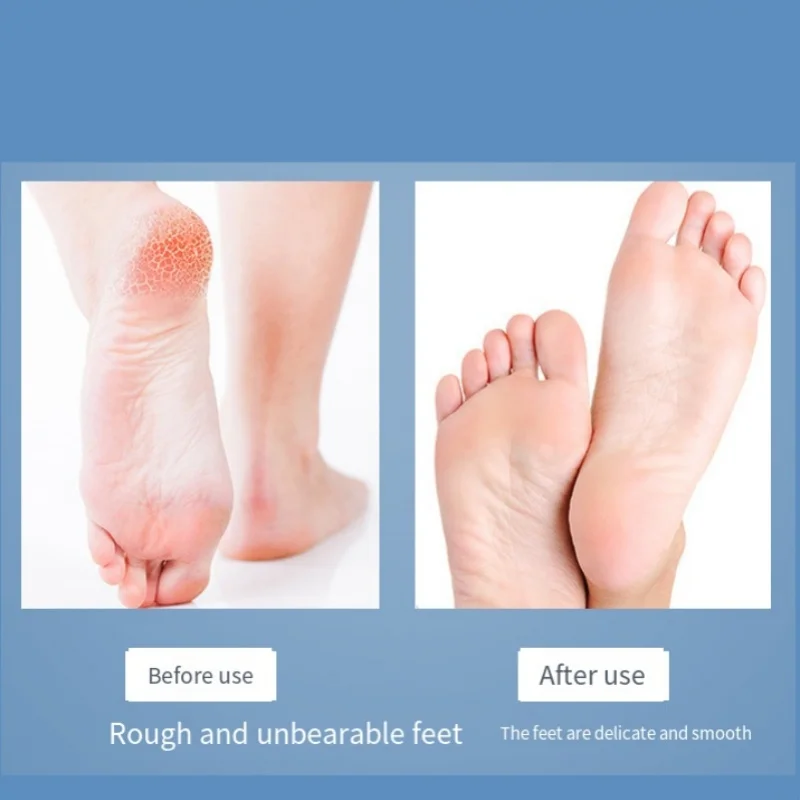 4 個のステンレス鋼フットプレートファイルセット家庭用ペディキュアツール角質除去足スクレーパー足ケアアーティファクト