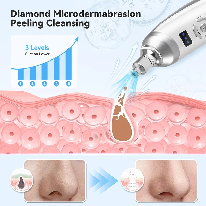 Protable Diamant Microdermabrasie Machine Handheld Mee-Eter Verwijdering Gezichtsverzorging Schoonheid Apparaat Voor Acne Littekens