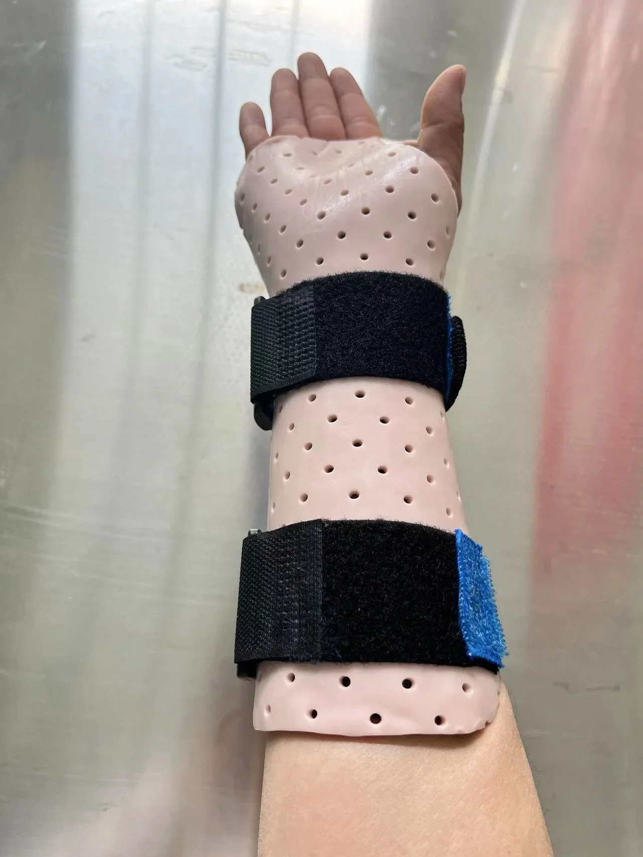 

Thermoplastic Splint for Hand Wrist Immobilization Brace Bandage Physiotherapy Functional Rehabilitation
