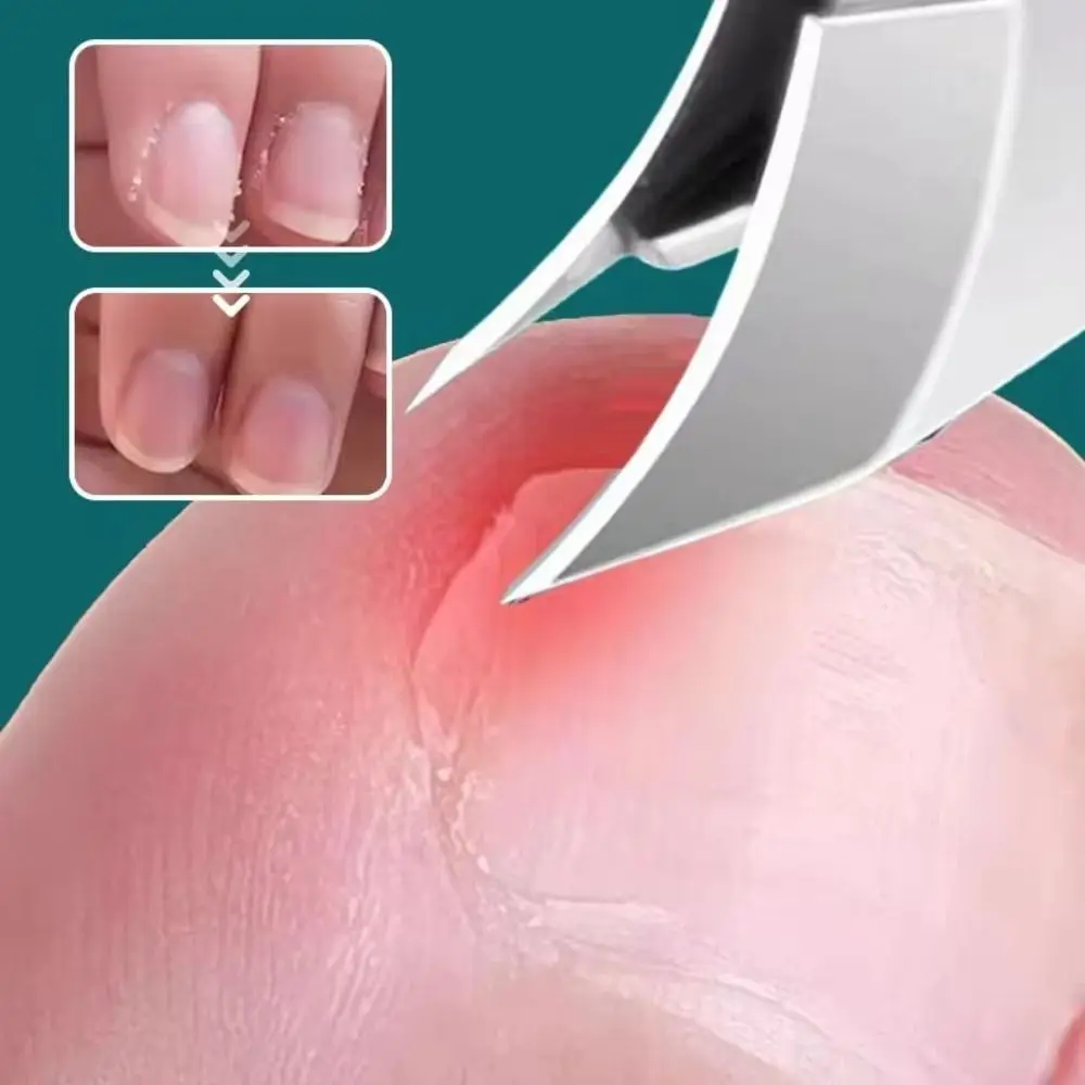 Professional Anti-Splash Slant Edge กรรไกรตัดเล็บ Eagle Beak Trim เล็บ Clipper เล็บสแตนเลสคีมตัดเล็บ