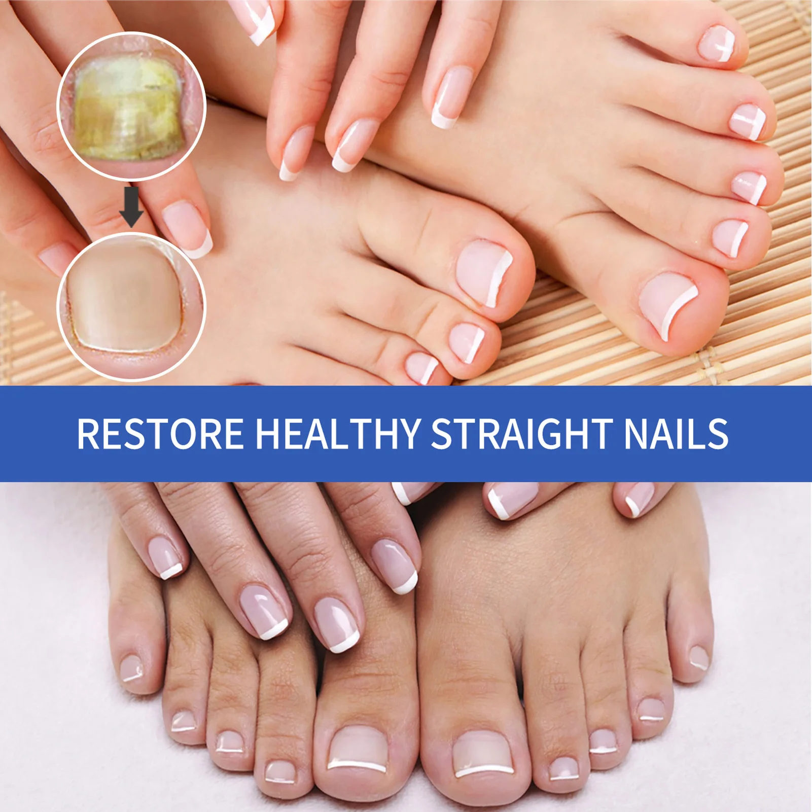 30ml Toenail Treatment Serum Repairing Damaged Nails  for Broken Cracked Split and Weak Nails