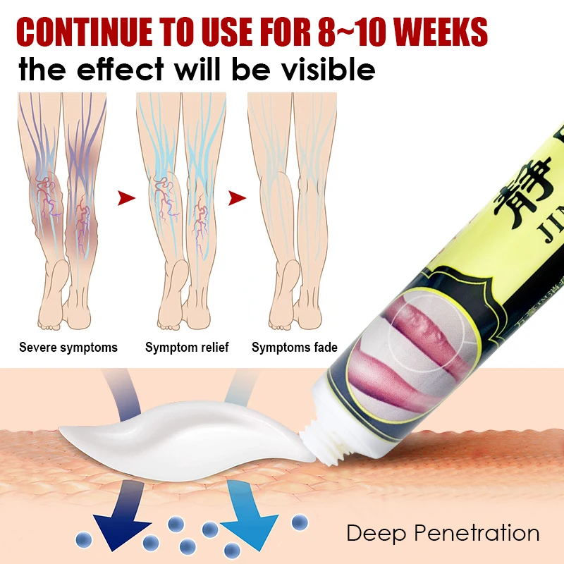 3pcs Varicose Vein Ointment Leg Vein Protrusion Blood Vessel Pain Relief Cream Varicosity Cream Repair Vascular Wall A1367