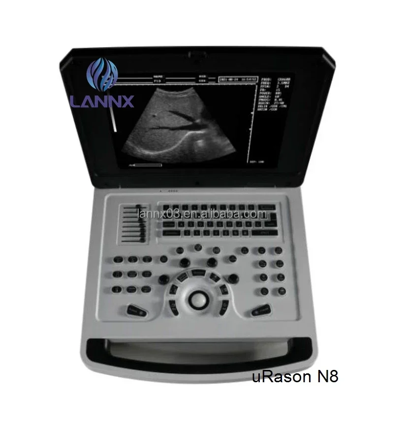 uRason N8 Well Priced Hospital Ultrasound Machine portable ultrasonic diagnostic scanner echocardiography