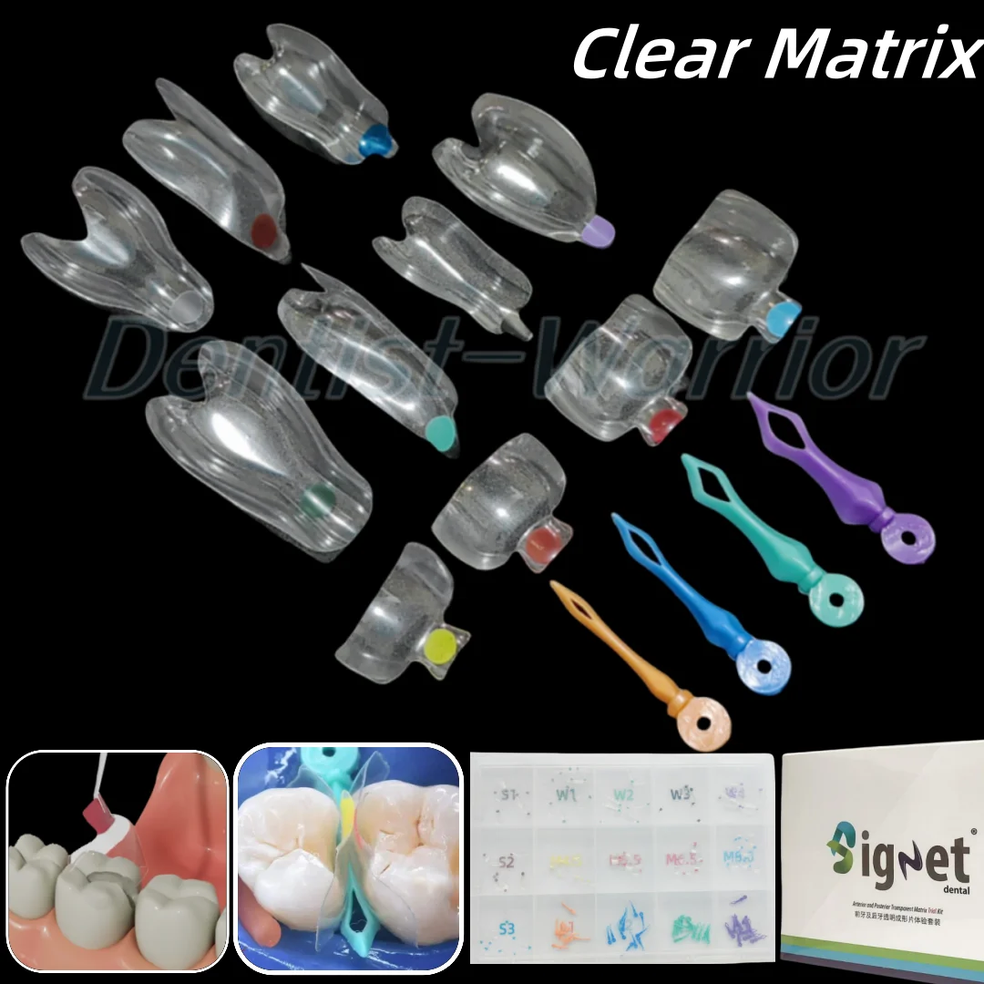 Dental Clear Matrix Diastema Matrices Wedges Similar with BioClear Matrice Fits Bioclear Black Triangle Class Restorative  ﻿
