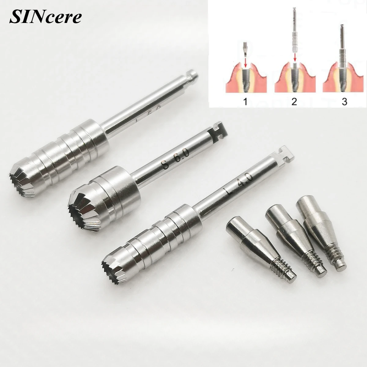 Dental Implant Bone Profiler Guide Screw Surgical Instrument Bone Grinding Oral Implant Peripheral Bone Fit for OSSTEM Dentium