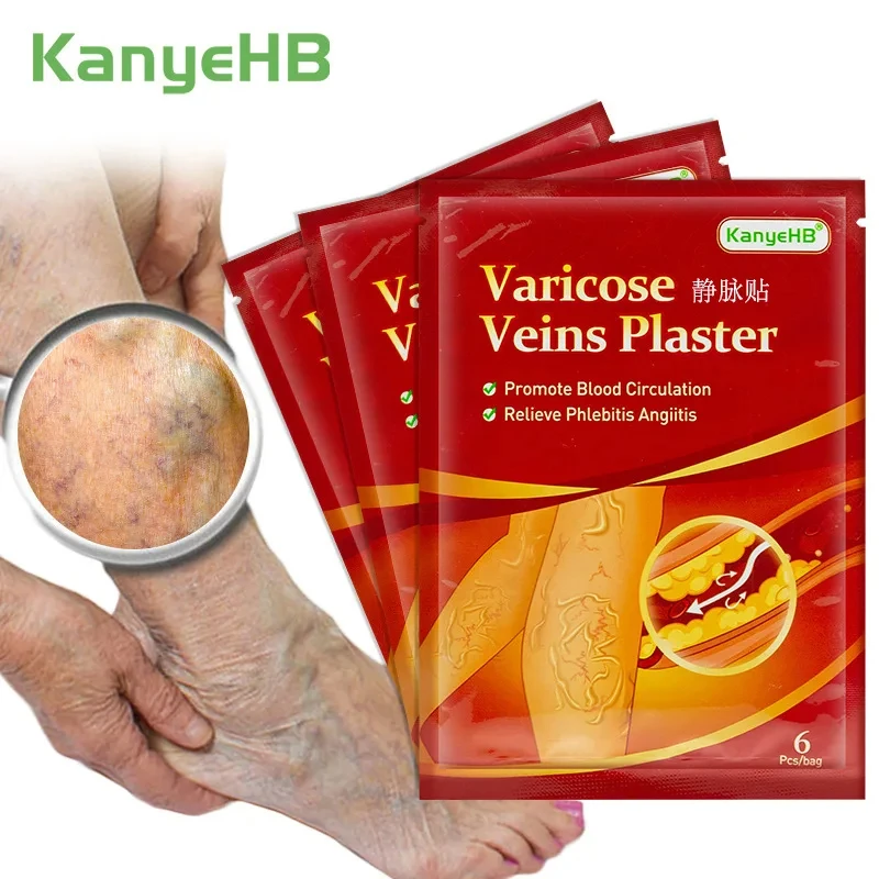 

48pcs Treatment For Varicose Veins Chinese Herbal Medicine Varicosity Angiitis Removal Phlebitis Spider Leg Veins Pain Plaster