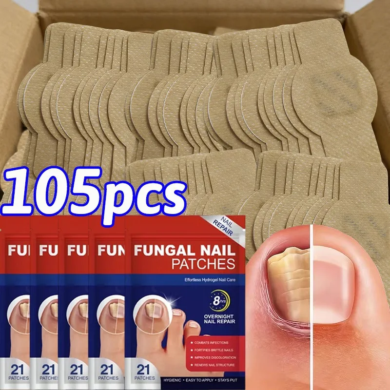 New Disposable Waterproof Toe Patch Nail Repair Patches Toenail Fungus Patch Sticky Toenail Care Nail Ingrown Correction Sticker