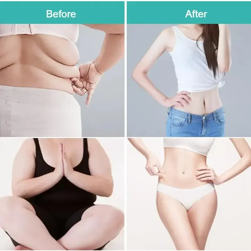 60g Detox Slimming Cream Anti-Cellulite Navel Slim Patch Fat Burning Skin Care Body Cream Effective Fat Burn Weight Loss 3CS020