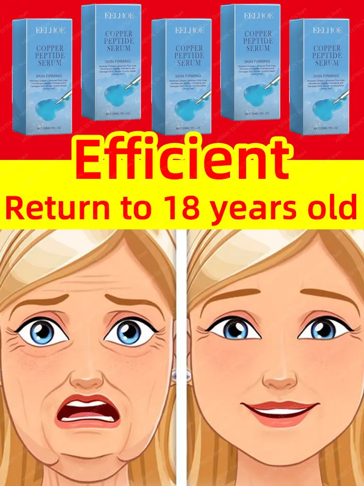 

Eliminate Neck Lines