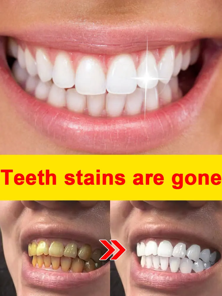 

Teeth Cleaning Smoke Coffee Tea Stain Tartar dissolve and stains