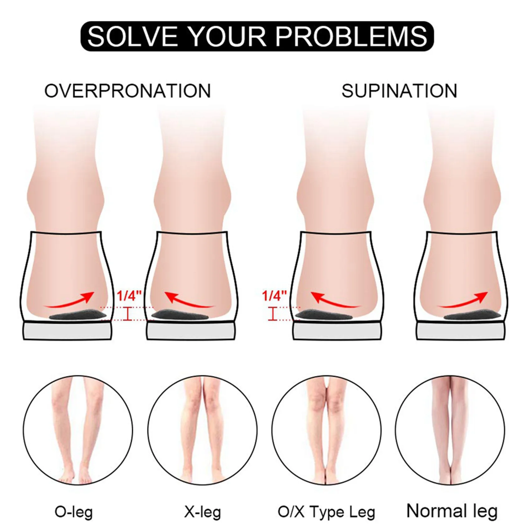 【SEE】2X Medial & Lateral Heel Wedge Silicone Insoles For Supination And Pronation, Corrective Adhesive Gel Shoe Inserts