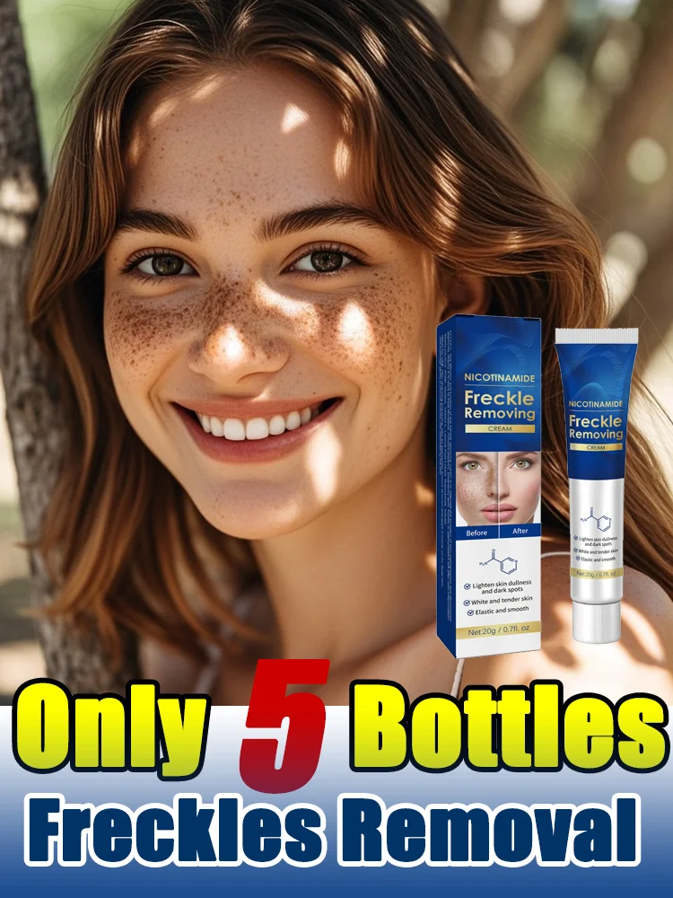 

Effictive Dark Spot Remover Cream for Face Removing Freckle Melasma Chloasma Senile Plaques Sunburn Cyasma Chorioplaque Freckle