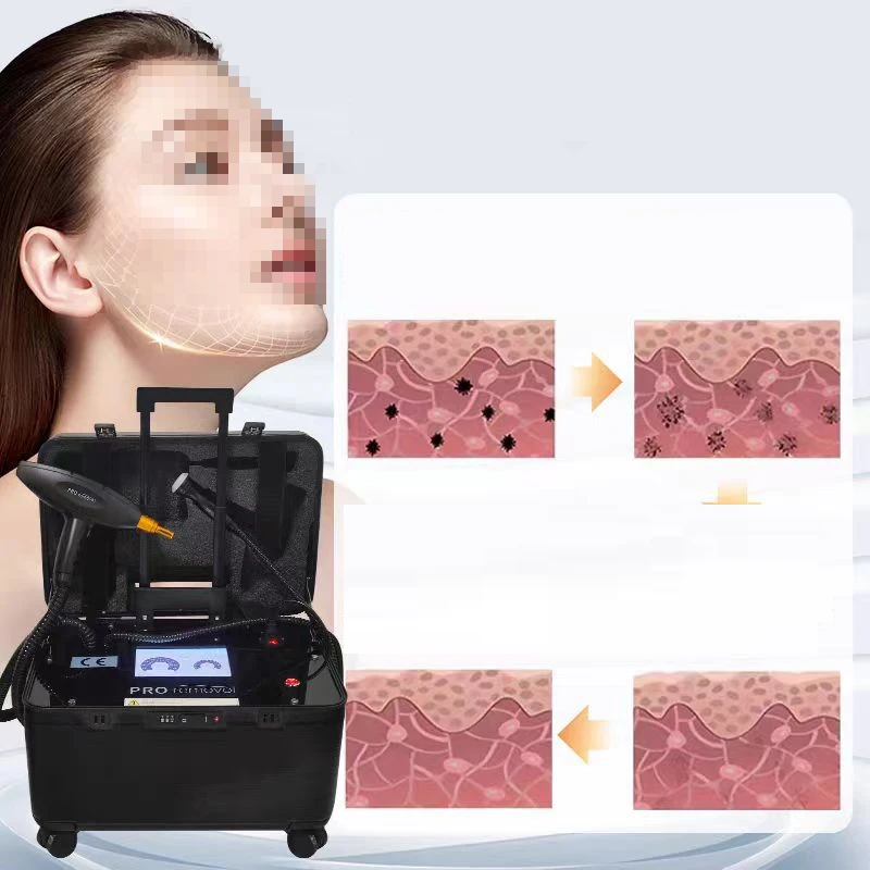 อุปกรณ์ความงามแบบพกพา