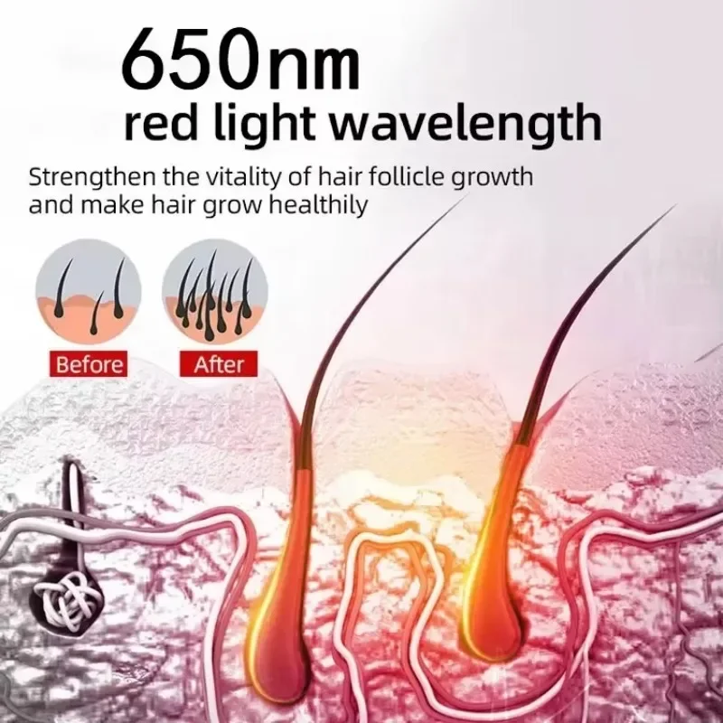 

Портативная лазерная кепка CE LLLT с ползунем 2025 пикселей, терапия красным светом 272, диодная лазерная кепка, лазерная шляпа для домашнего лечения роста волос