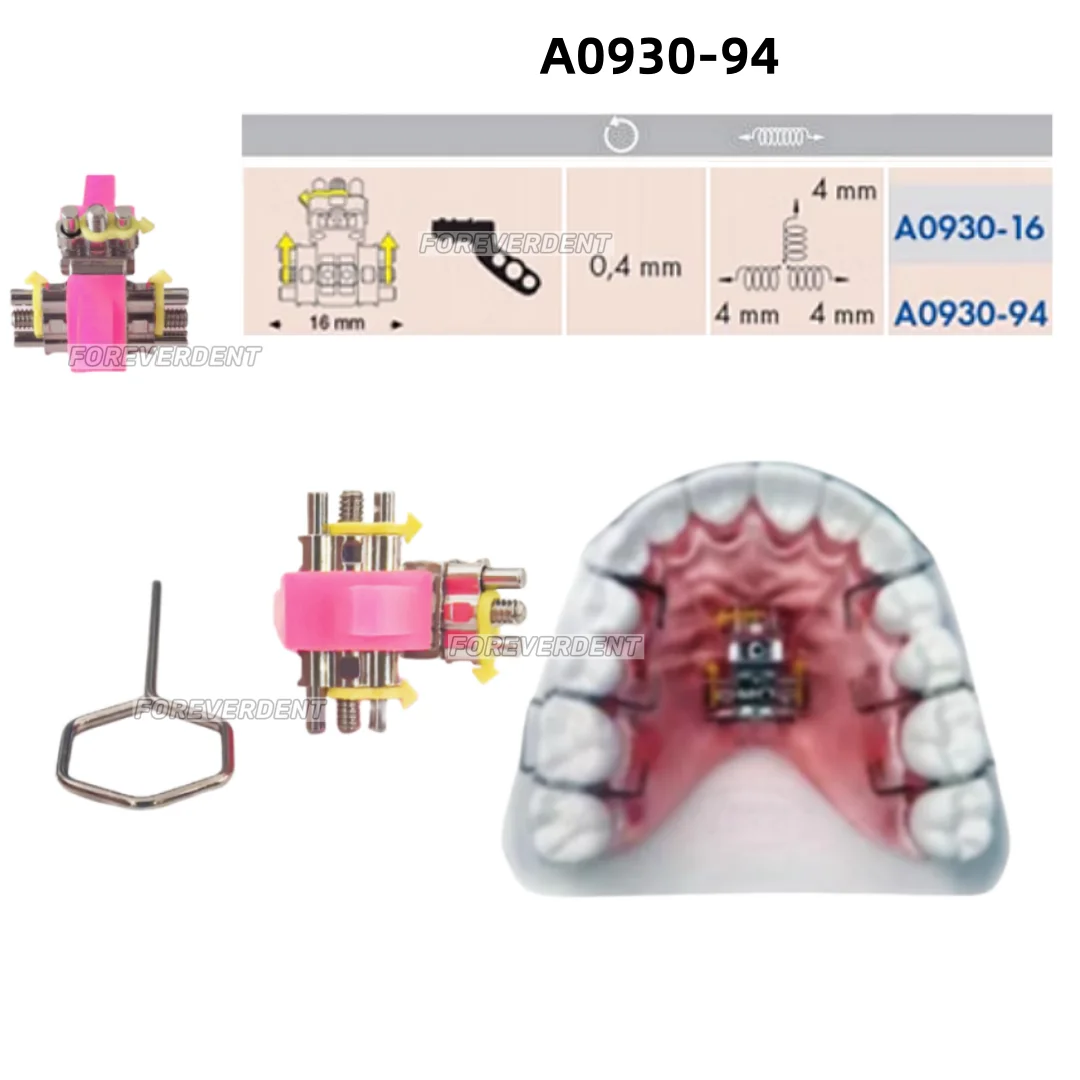 1Kit Dental Three Way Screw Expansion Screws for Upper Appliances Leone Orthodontic A0930-94