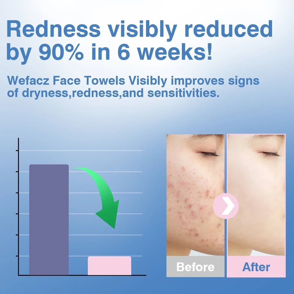 150 عدد مناشف الوجه القابلة للتحلل الحيوي للاستعمال مرة واحدة، مناشف تنظيف ناعمة، إزالة مكياج البشرة الحساسة، السفر، رعاية الحيوانات الأليفة المنزلية