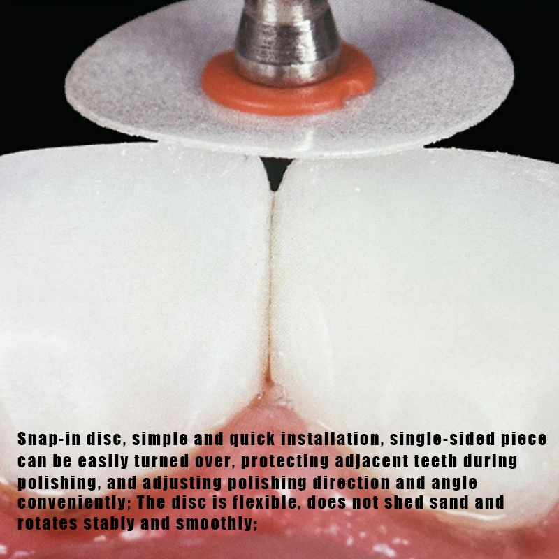 Dental Composite Polishing Discs Contouring Mandrel Translucent Snap Type Finishing&Polishing Discs Restoration Material Dentist view 4