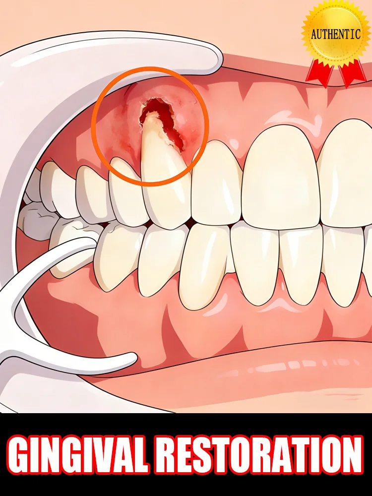 

Taziazi aziaziвы, В течение всего 7 дней, десны, восстановленные и покрытые зубами