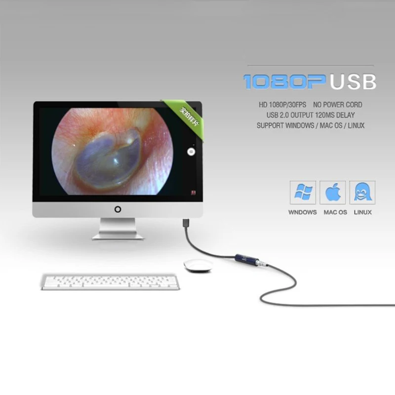 Image 6: Système de caméra endoscopique d'endoscopie HD Portable, ensemble USB 1080P pour Hawk