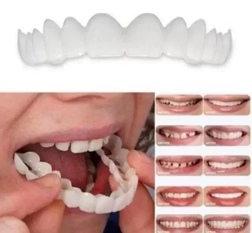 

Sdatter 2 Sets =4 pieces Instant Perfect Smile Teeth Teeth Veneers Whitening Cosmetic Denture Fake Tooth Cover Oral Hygiene Tool